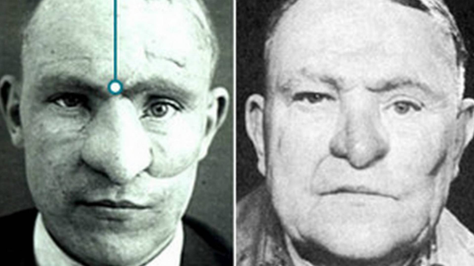 La historia plástica